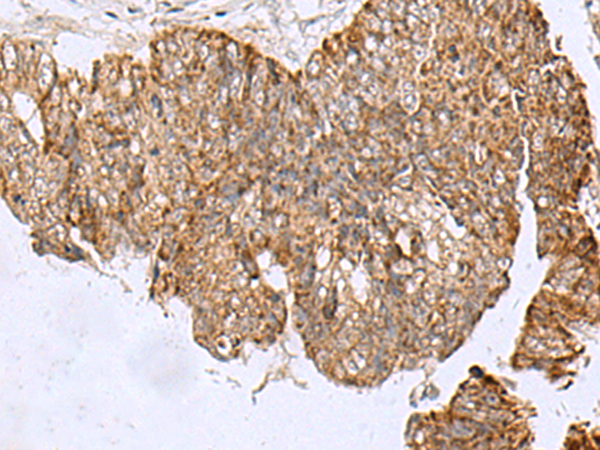 Anti-HCCS Rabbit Polyclonal Antibody