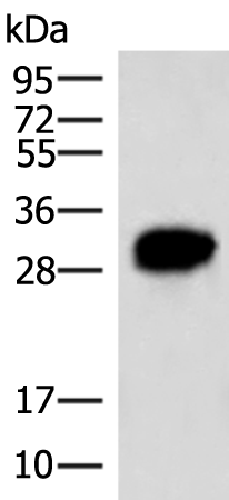 Anti-HCCS Rabbit Polyclonal Antibody