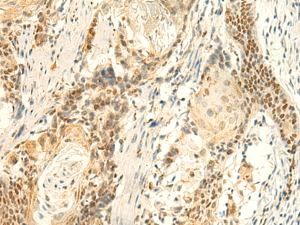 Anti-HMBOX1 Rabbit Polyclonal Antibody