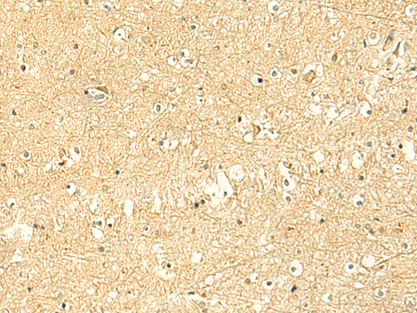 Anti-RNA Polymerase III Subunit C6 Rabbit Polyclonal Antibody