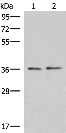 Anti-RNA Polymerase III Subunit C6 Rabbit Polyclonal Antibody