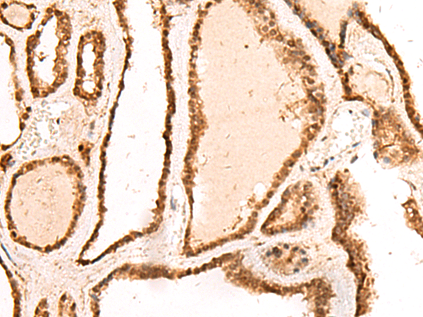Anti-RETREG1 Rabbit Polyclonal Antibody