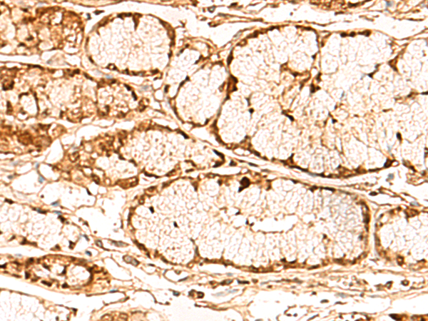 Anti-AMPK gamma 2 Rabbit Polyclonal Antibody