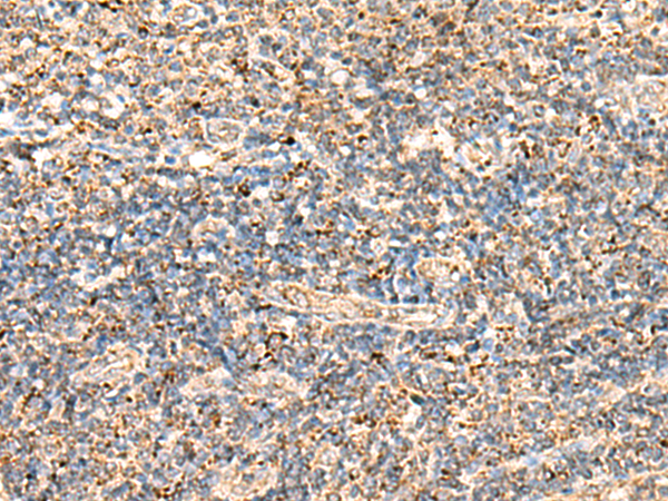 Anti-ECH1 Rabbit Polyclonal Antibody