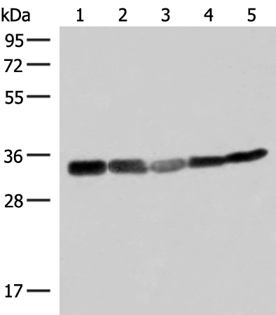 Anti-ECH1 Rabbit Polyclonal Antibody