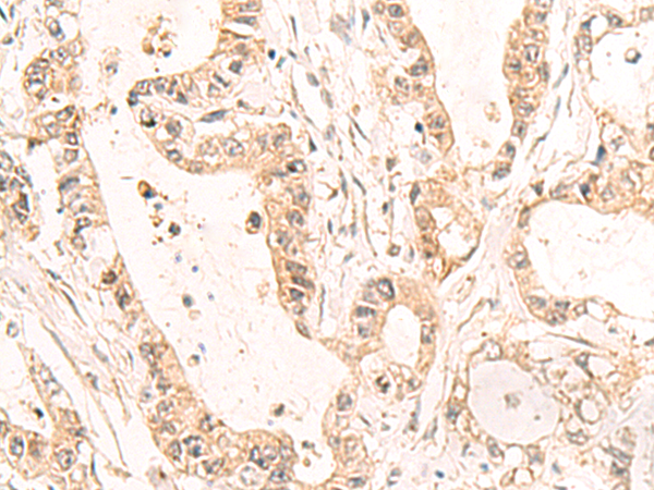 Anti-C19orf57 Rabbit Polyclonal Antibody