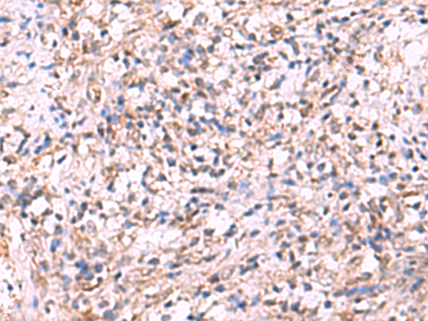 Anti-LMCD1 Rabbit Polyclonal Antibody