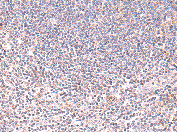 Anti-DHPS Rabbit Polyclonal Antibody
