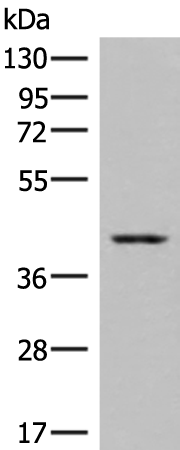 Anti-DHPS Rabbit Polyclonal Antibody