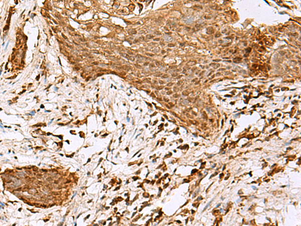 Anti-SAMSN1 Rabbit Polyclonal Antibody