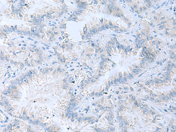 Anti-ATP6V1C1 Rabbit Polyclonal Antibody
