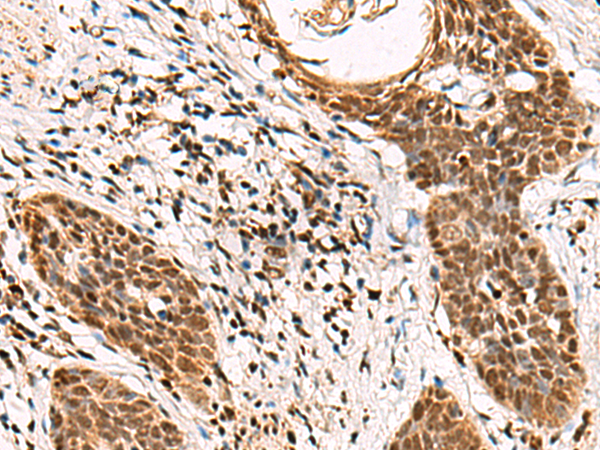 Anti-GABPB1 Rabbit Polyclonal Antibody