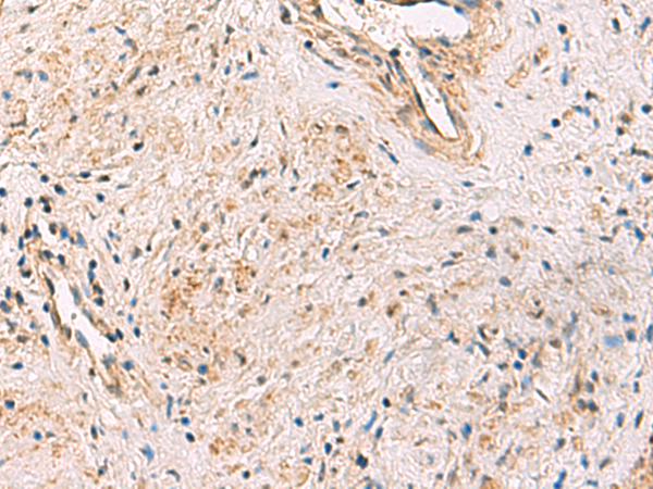 Anti-PCYT2 Rabbit Polyclonal Antibody