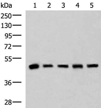 Anti-PCYT2 Rabbit Polyclonal Antibody
