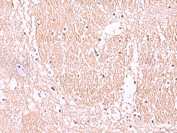 Anti-RIC8A Rabbit Polyclonal Antibody