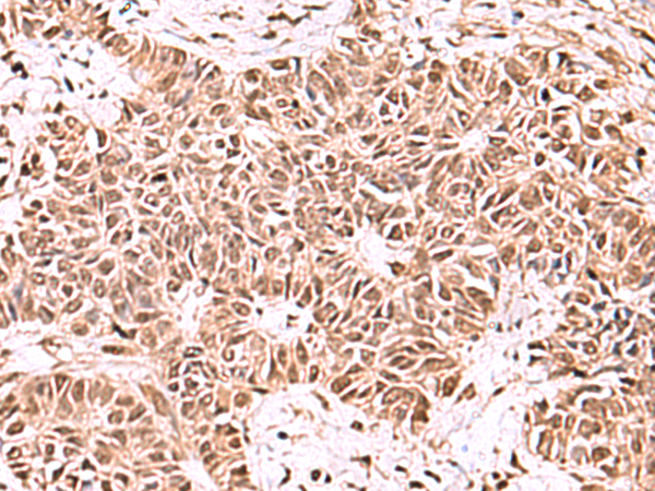 Anti-ACTL6B Rabbit Polyclonal Antibody