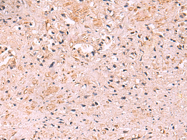 Anti-beta IIA Tubulin Rabbit Polyclonal Antibody
