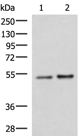 Anti-beta IIA Tubulin Rabbit Polyclonal Antibody