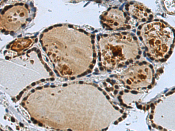 Anti-IKZF2 Rabbit Polyclonal Antibody