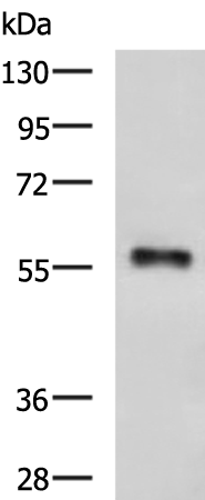 Anti-IKZF2 Rabbit Polyclonal Antibody