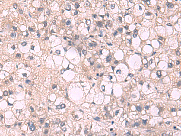 Anti-KPNA2 Rabbit Polyclonal Antibody