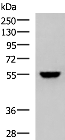 Anti-KPNA2 Rabbit Polyclonal Antibody