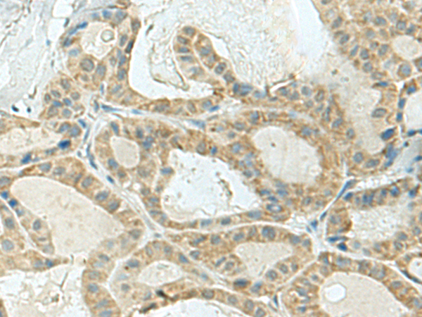 Anti-KLC2 Rabbit Polyclonal Antibody