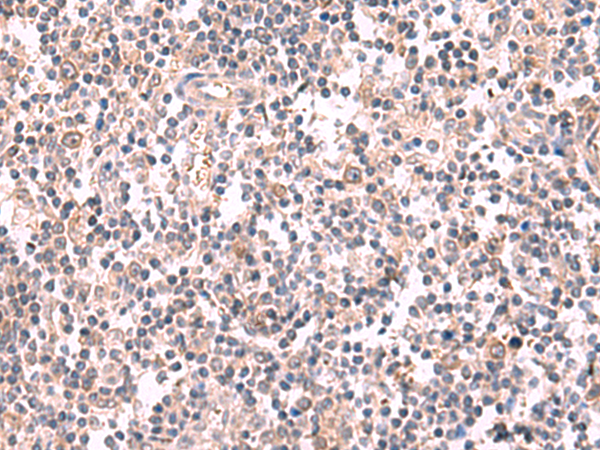 Anti-GSPT2 Rabbit Polyclonal Antibody