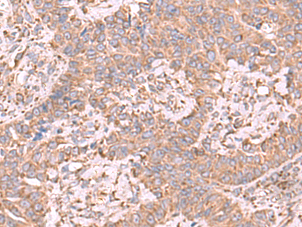 Anti-eEF1D Rabbit Polyclonal Antibody