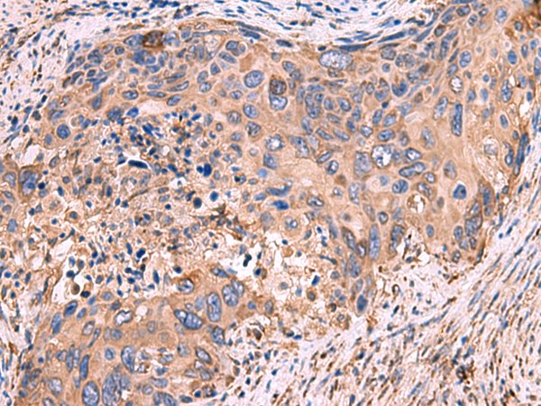 Anti-beta Glucuronidase Rabbit Polyclonal Antibody