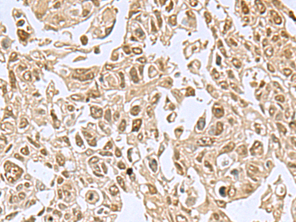 Anti-NVL Rabbit Polyclonal Antibody