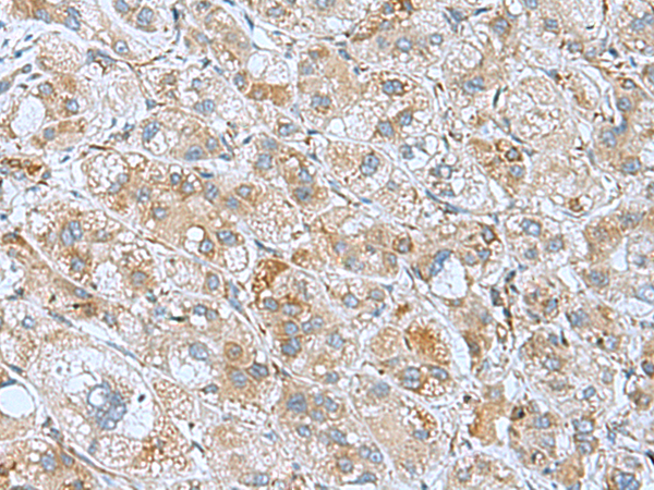 Anti-DHX58 Rabbit Polyclonal Antibody
