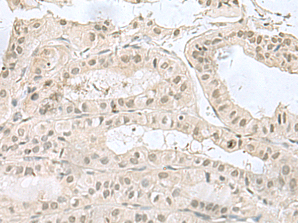 Anti-PCBD1 Rabbit Polyclonal Antibody