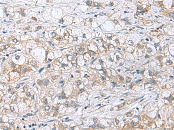 Anti-PHPT1 Rabbit Polyclonal Antibody