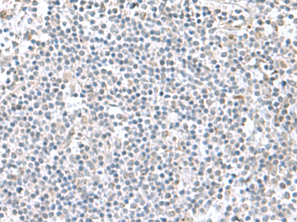 Anti-PAM16 Rabbit Polyclonal Antibody