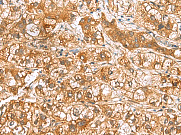 Anti-RIDA Rabbit Polyclonal Antibody