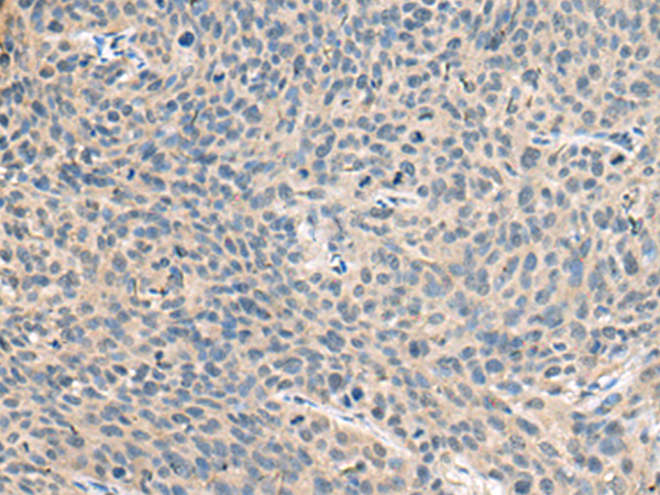 Anti-RNase 1 Rabbit Polyclonal Antibody
