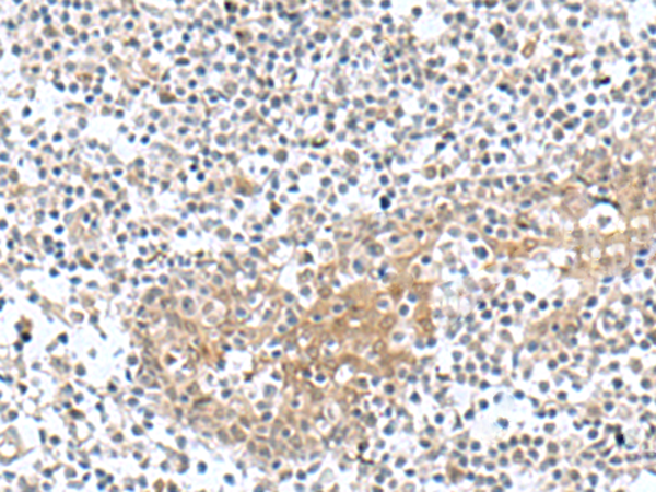 Anti-Troponin C Rabbit Polyclonal Antibody