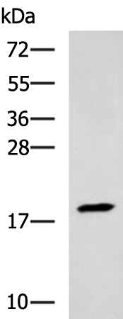 Anti-Troponin C Rabbit Polyclonal Antibody
