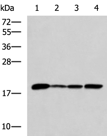 Anti-AK6 Rabbit Polyclonal Antibody
