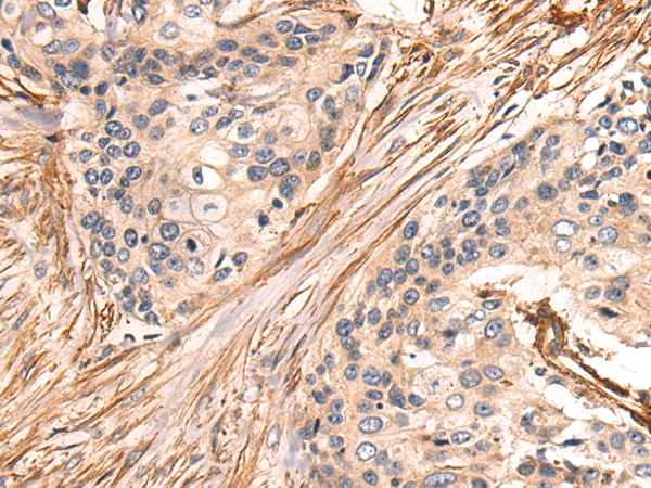Anti-HYI Rabbit Polyclonal Antibody