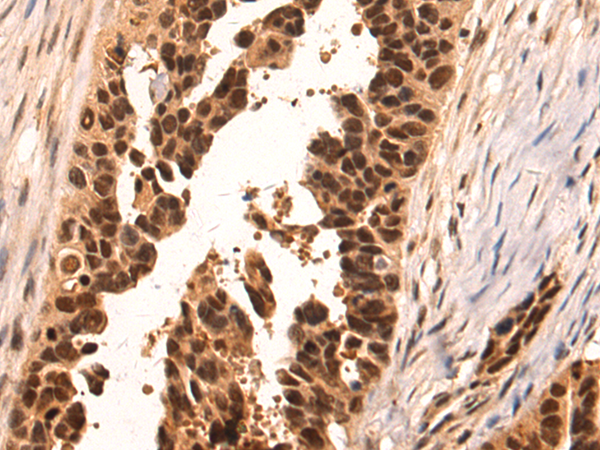 Anti-MED30 Rabbit Polyclonal Antibody