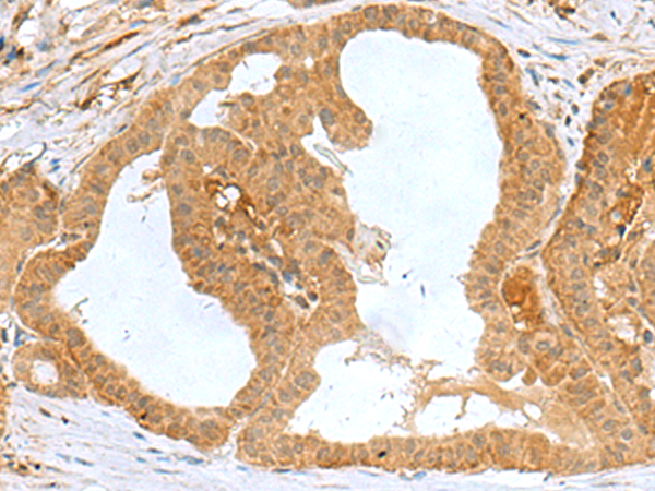 Anti-MRPS28 Rabbit Polyclonal Antibody