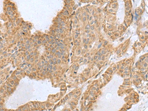 Anti-CSRP2 Rabbit Polyclonal Antibody