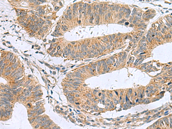Anti-MARCKSL1 Rabbit Polyclonal Antibody