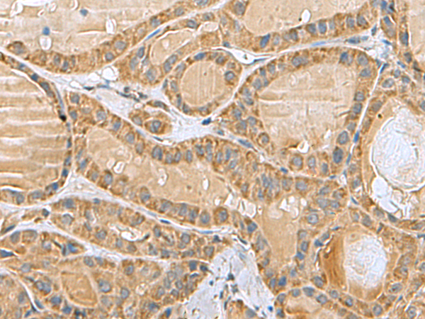 Anti-MRPL40 Rabbit Polyclonal Antibody