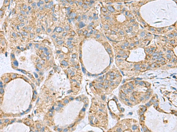 Anti-Clathrin Light Chain B Rabbit Polyclonal Antibody