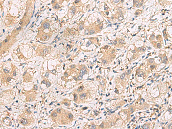 Anti-Rab39A Rabbit Polyclonal Antibody