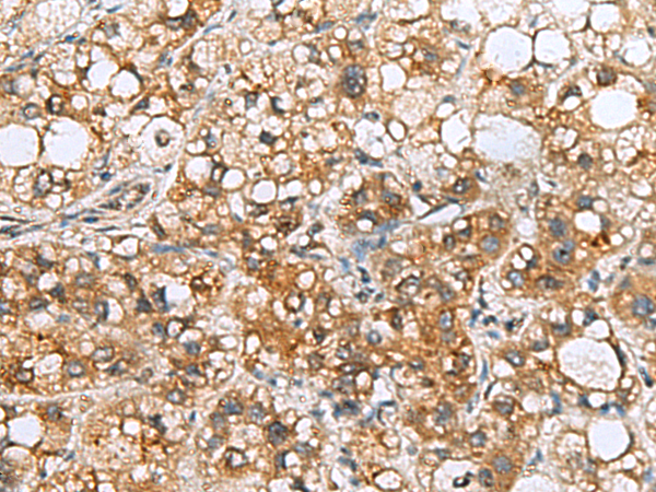 Anti-TMED10 Rabbit Polyclonal Antibody