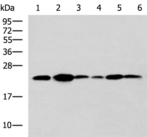 Anti-TMED10 Rabbit Polyclonal Antibody